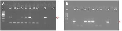 Serum IgG Anti-Toxoplasma gondii Antibody Concentrations Do Not Correlate Nested PCR Results in Blood Donors